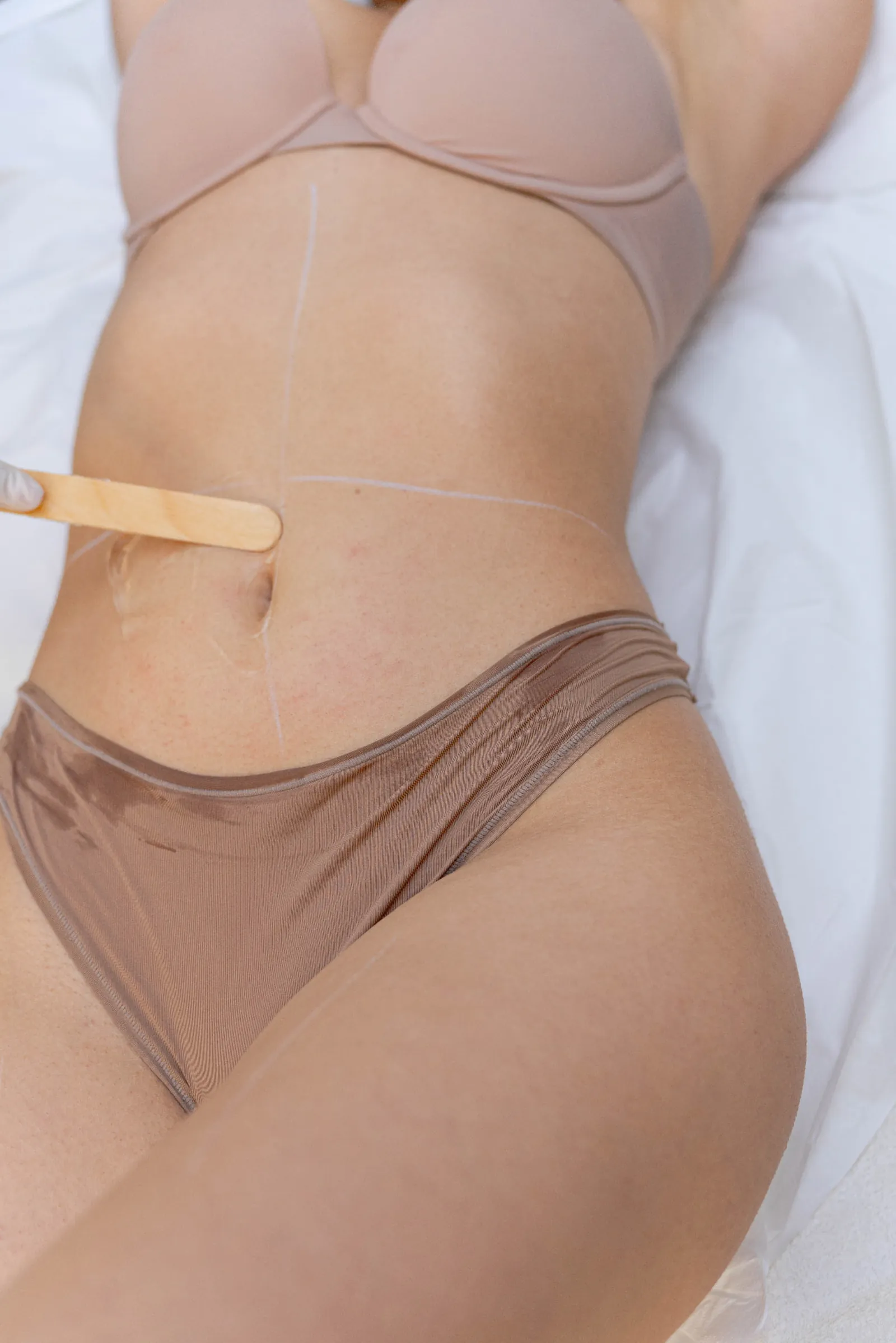 Diodenlaser-Behandlung zur dauerhaften Haarentfernung bei Beauty & Laser Bar in Köln
